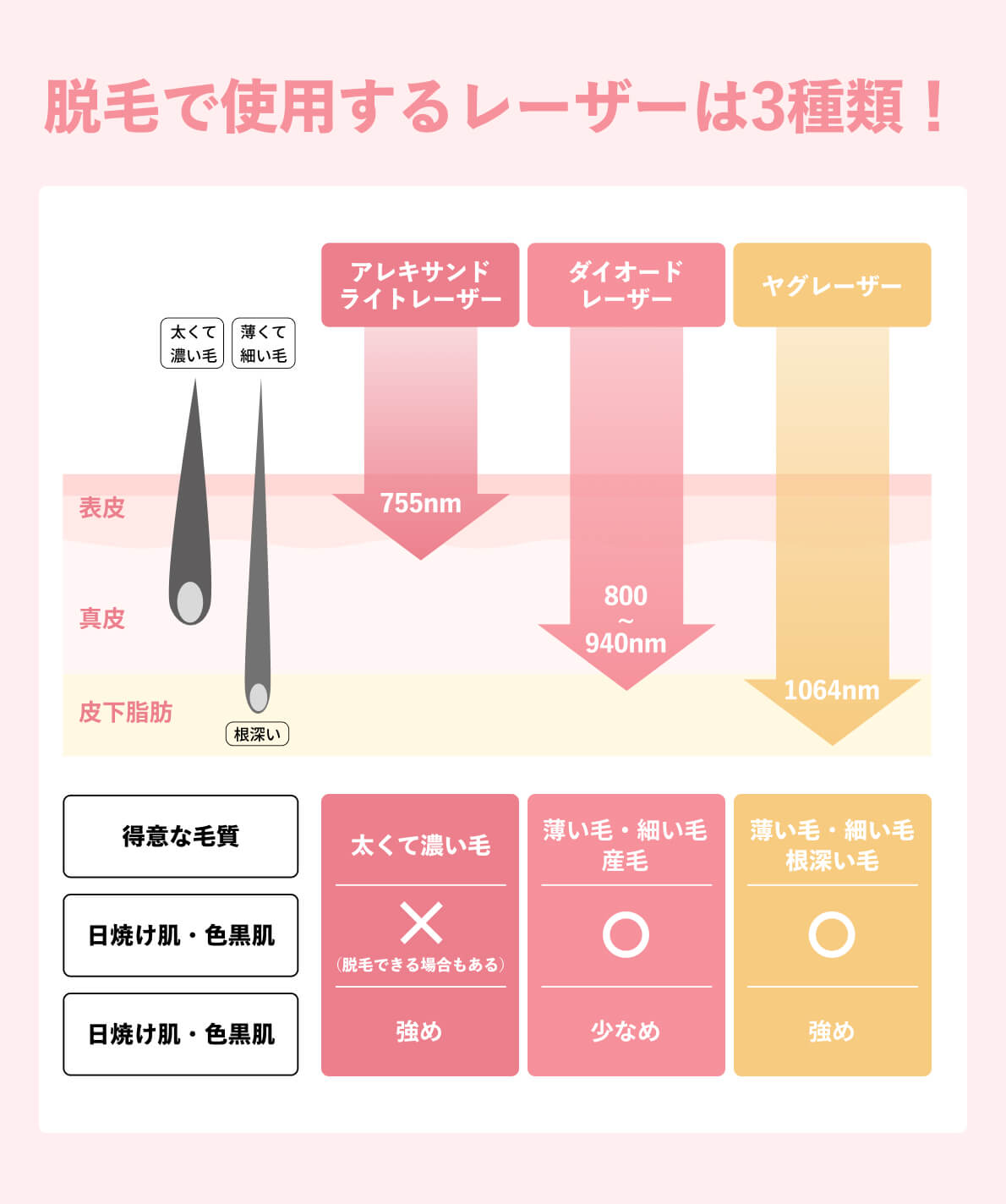 レーザー種類