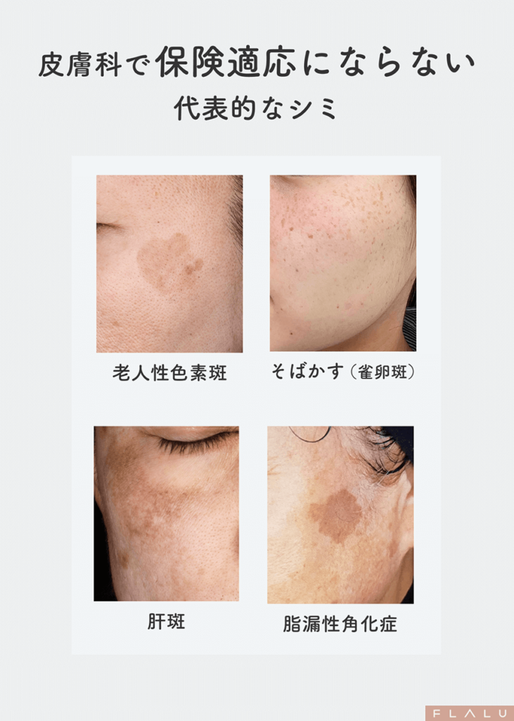 6_シミ一覧_保険適応にならない 1