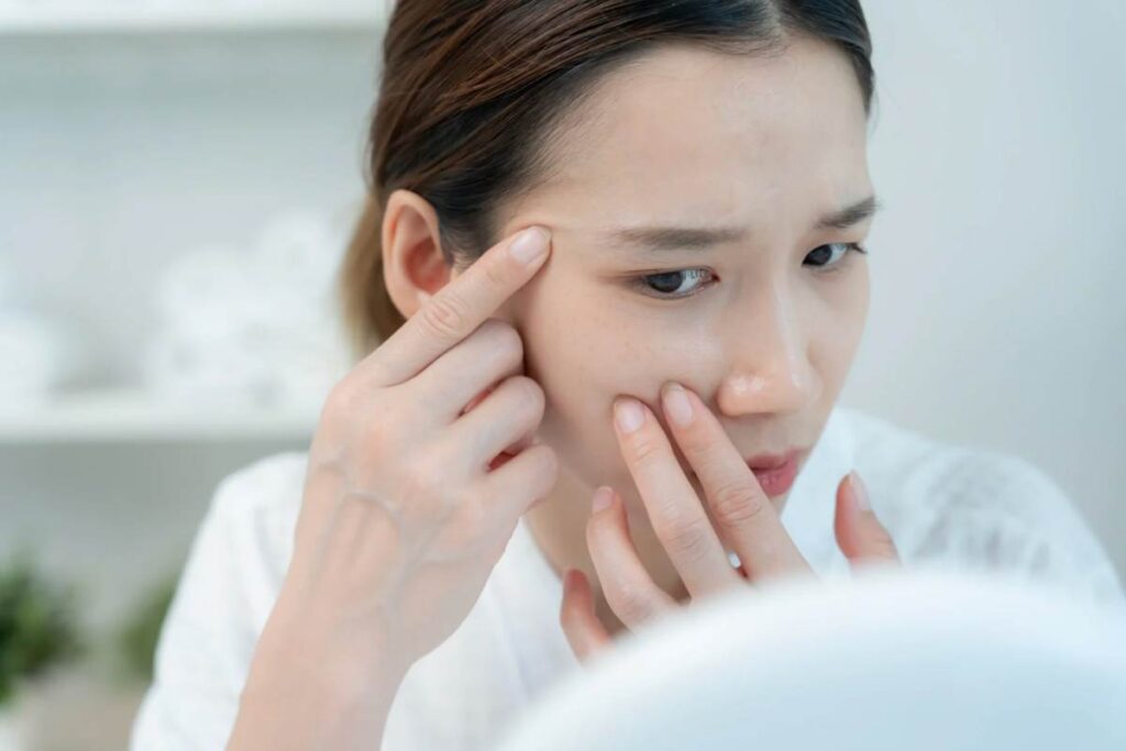 シミ取りレーザーとは？仕組みと向いているシミ