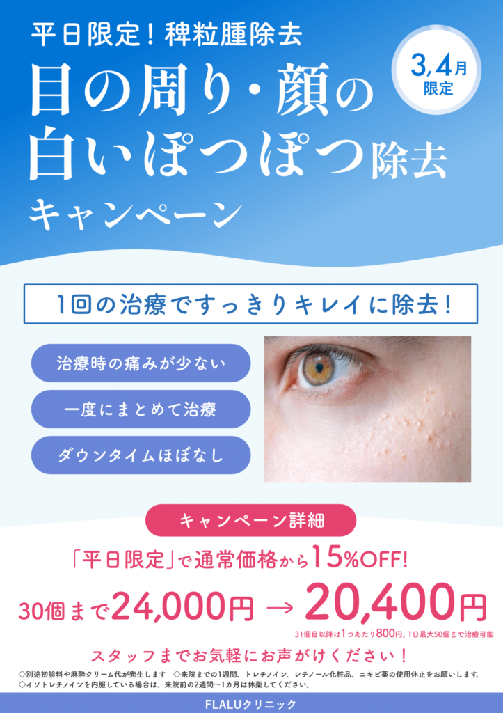 3月4月キャンペーン