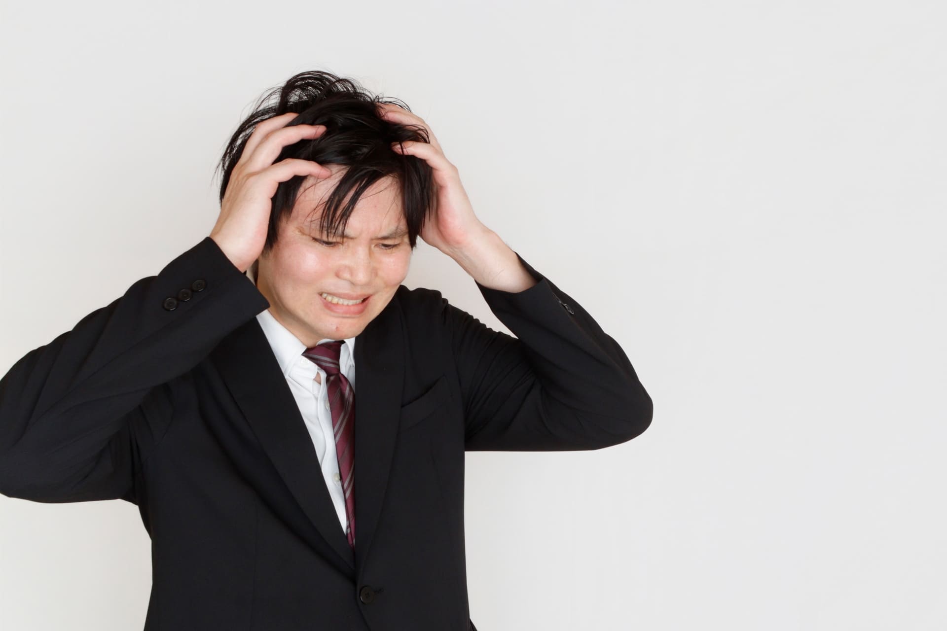 AGAによる若ハゲに悩む男性イメージ