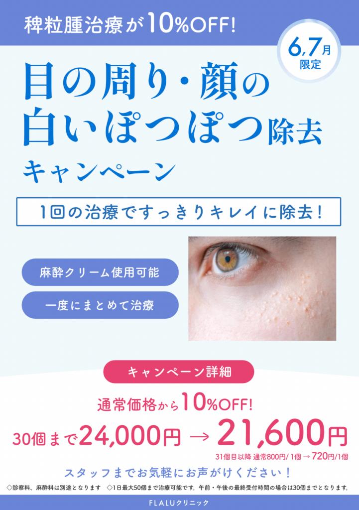 大阪院6月7月キャンペーン:稗粒腫