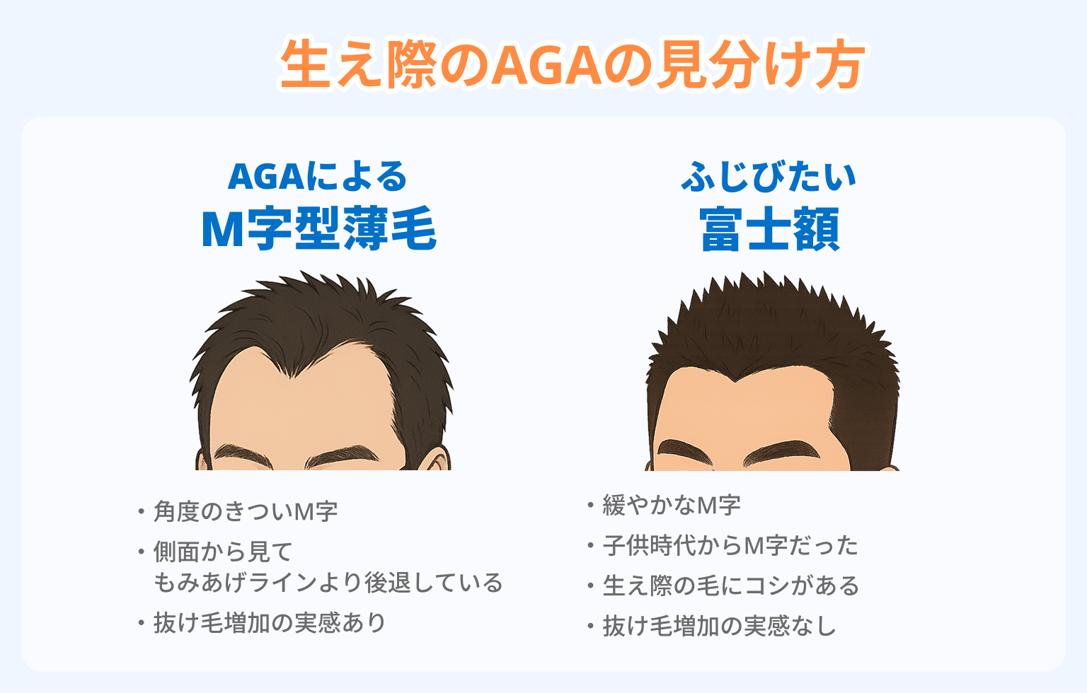 生え際のAGAの見分け方
