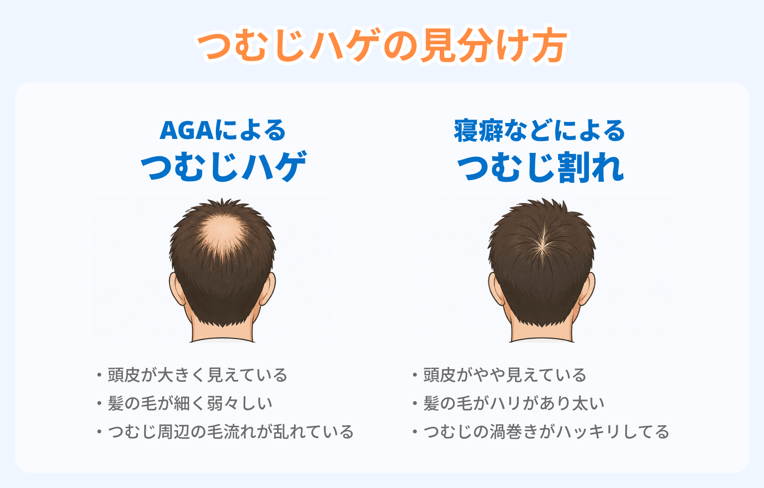 つむじハゲの見分け方