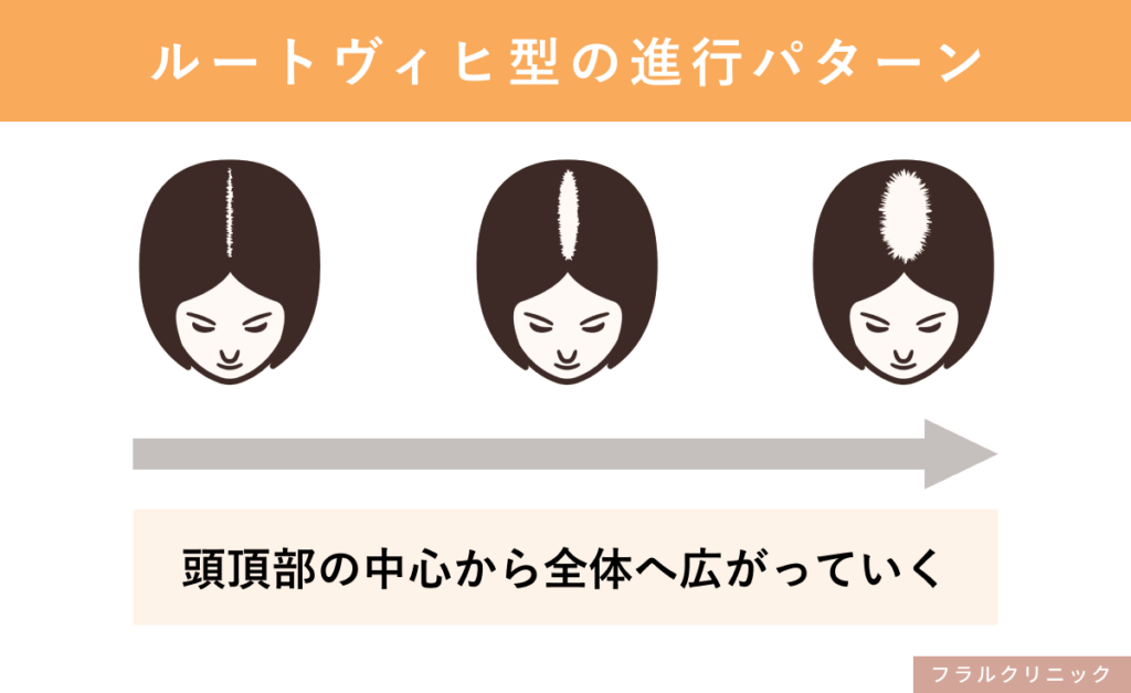 3_FAGA_FAGAの進行と初期の症状_2