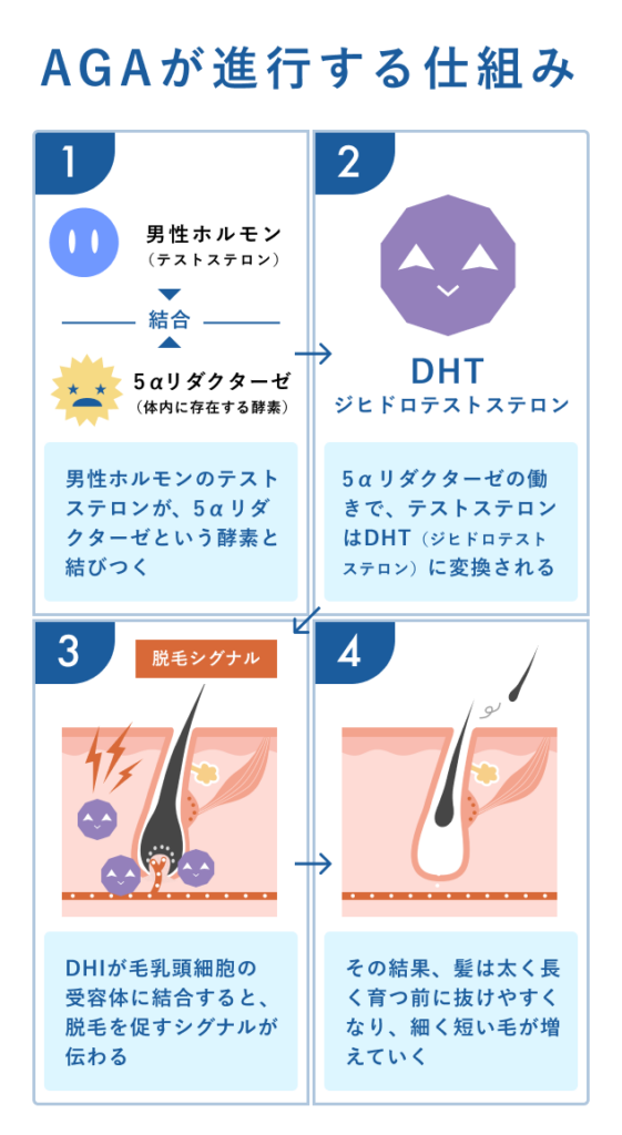 5_AGA_男性ホルモンの影響_1
