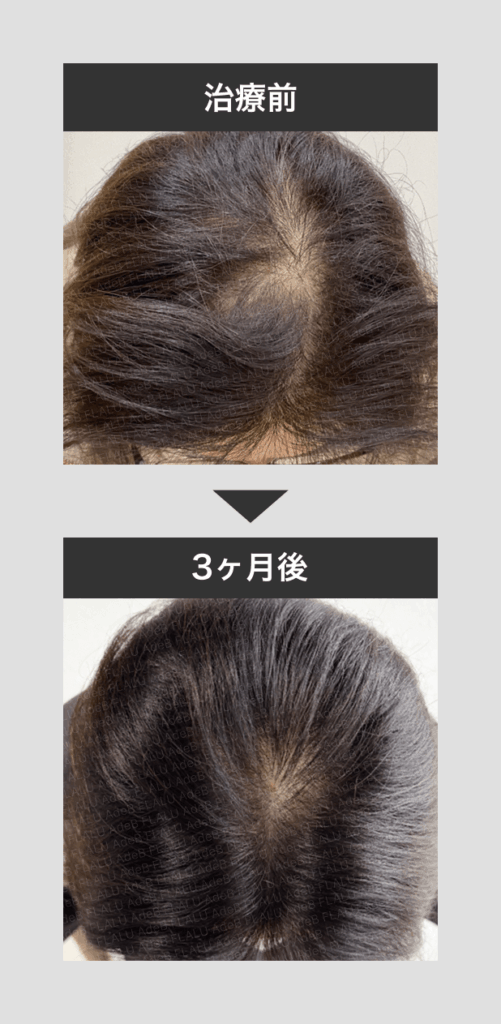 黒髪生活_3ヶ月_50代女性_10474