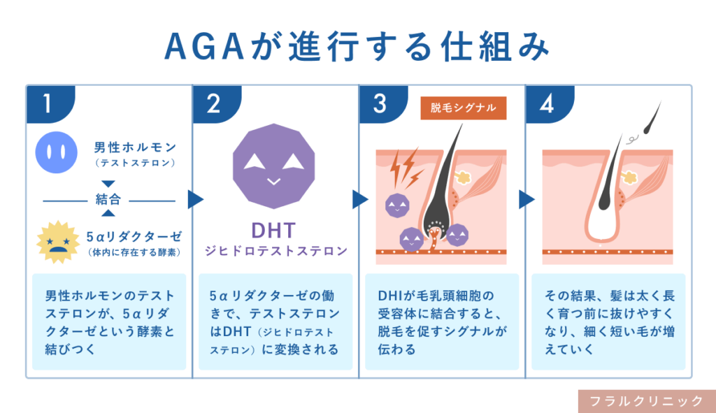 5_AGA_男性ホルモンの影響_2