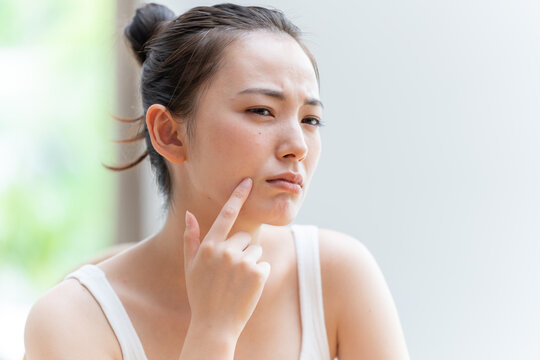 シミの種類は全部同じではない
