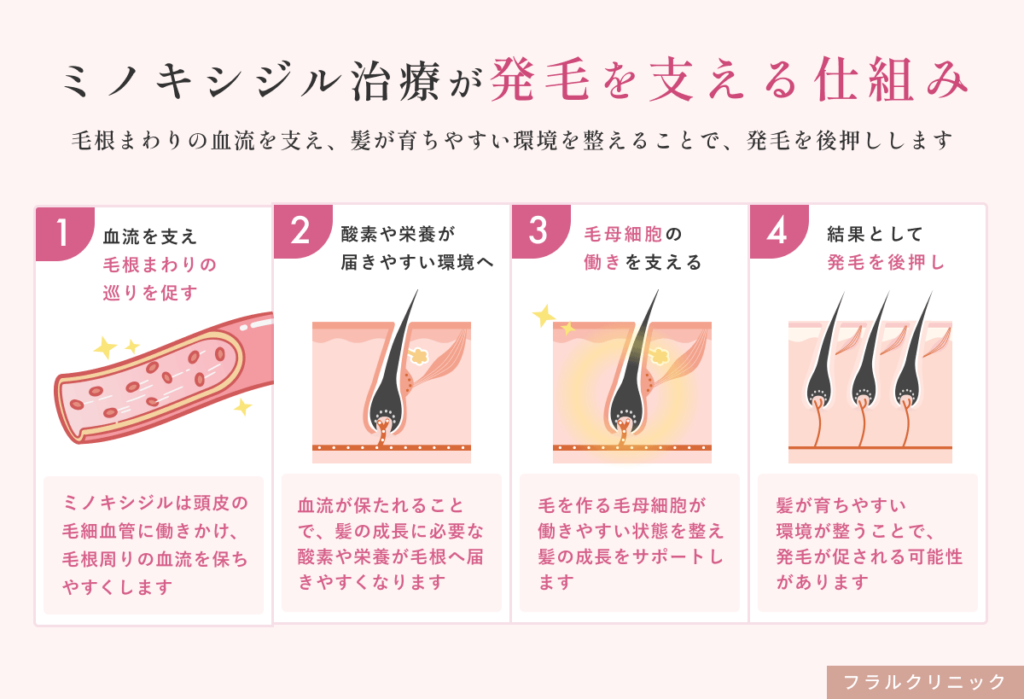 3_ミノキシジルが女性の薄毛に効く理由_女性の薄毛にミノキシジル