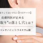 文字起こし記事_シミ取りしてはいけない5つのケース_MV (1)