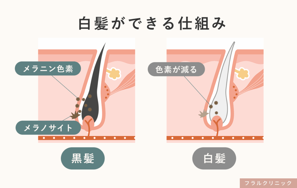 3_白髪サプリ_髪の色はメラニン色素によってつくられています