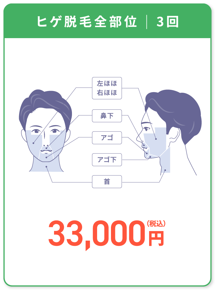 フレイアクリニックメンズ_ヒゲ全体脱毛プラン