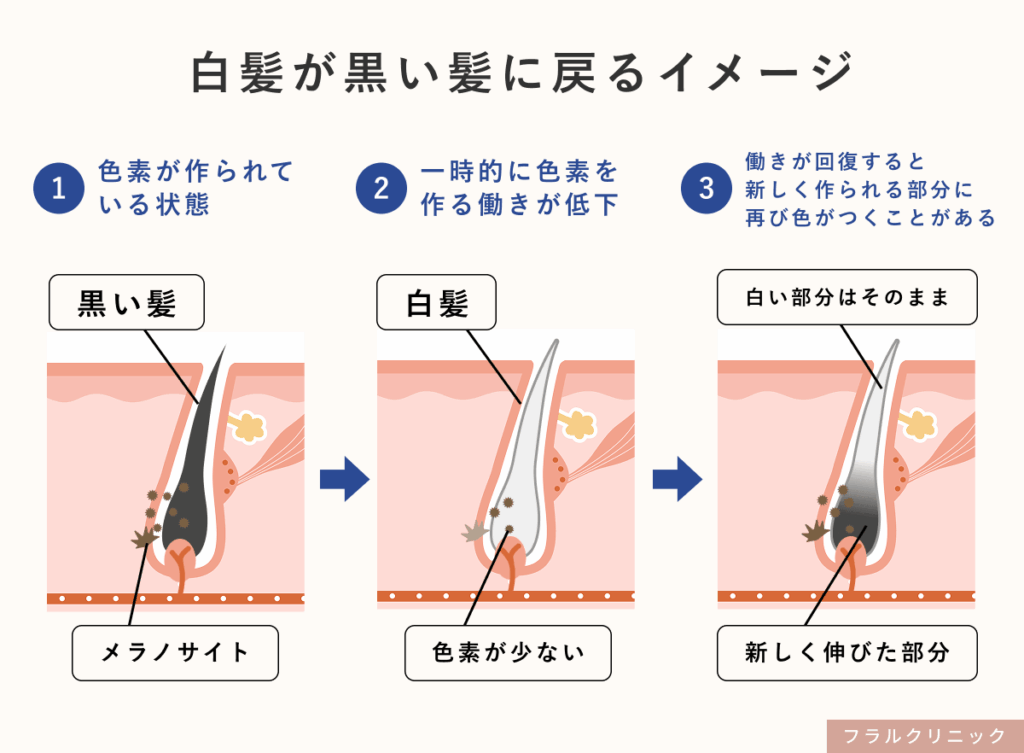 5_白髪サプリ_白髪サプリを飲めば白髪は黒くなる?