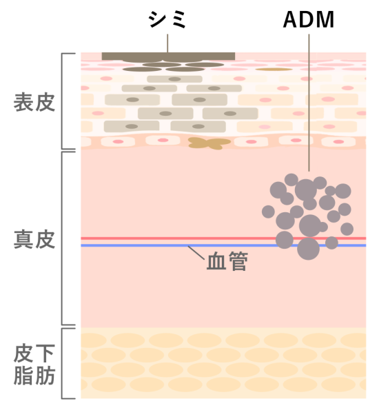 シミとADMの違いを示した図解