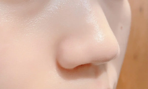 メラニン毛穴