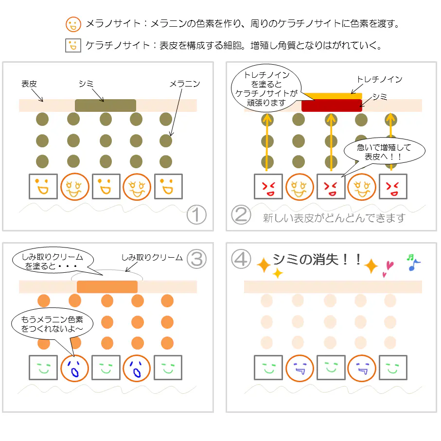 シミ治療