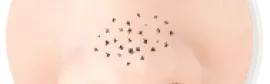 毛穴のお悩み