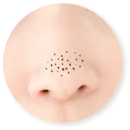 毛穴のお悩み