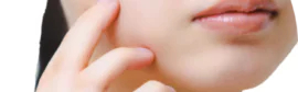 脂腺腫（脂腺増殖症）の原因と治療方法