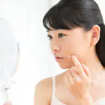 粉瘤