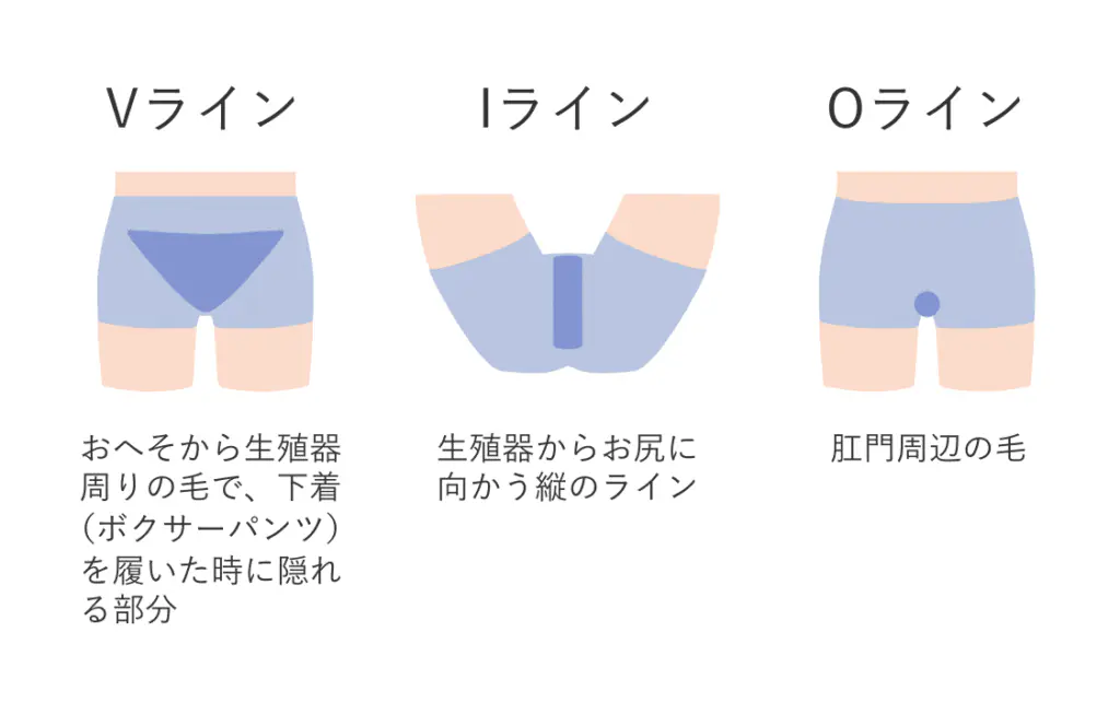 メンズVIO脱毛の施術範囲（Vライン・Iライン・Oライン）イメージ