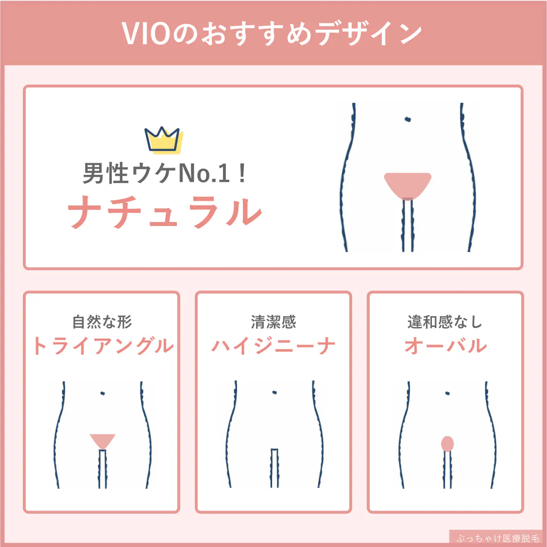 “vio脱毛おすすめデザイン”