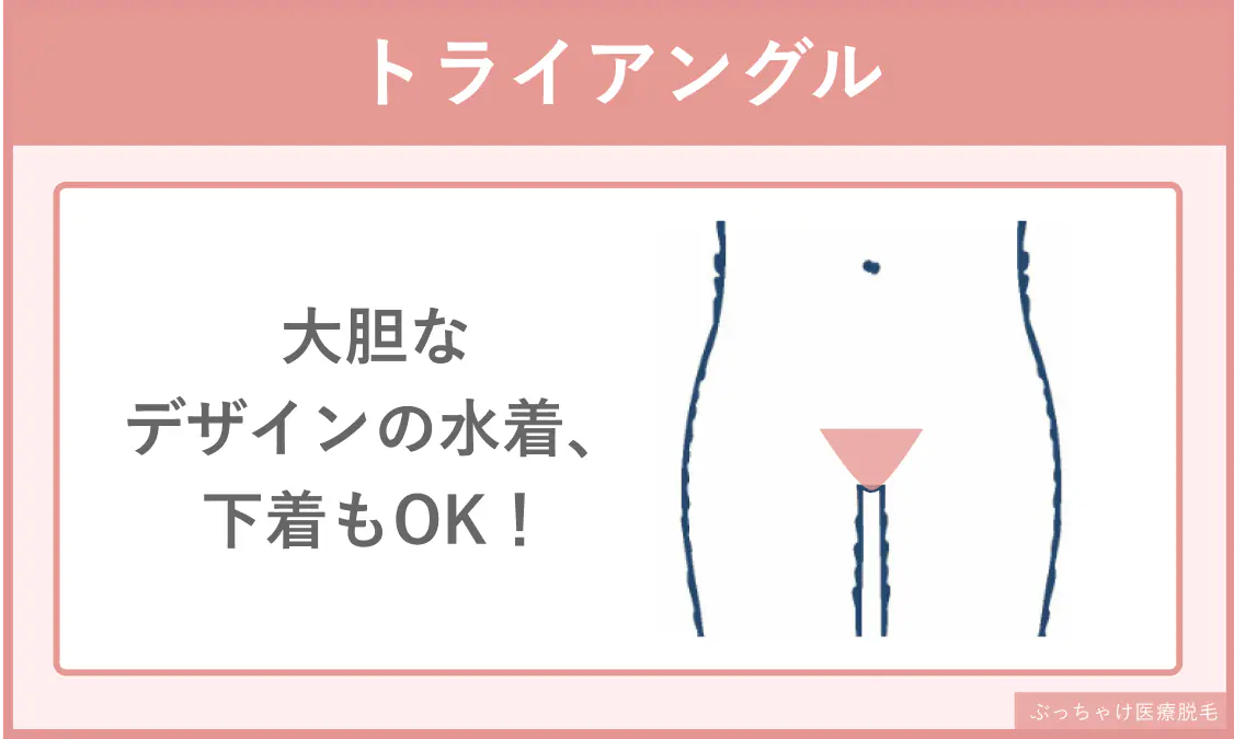 “トライアングル”