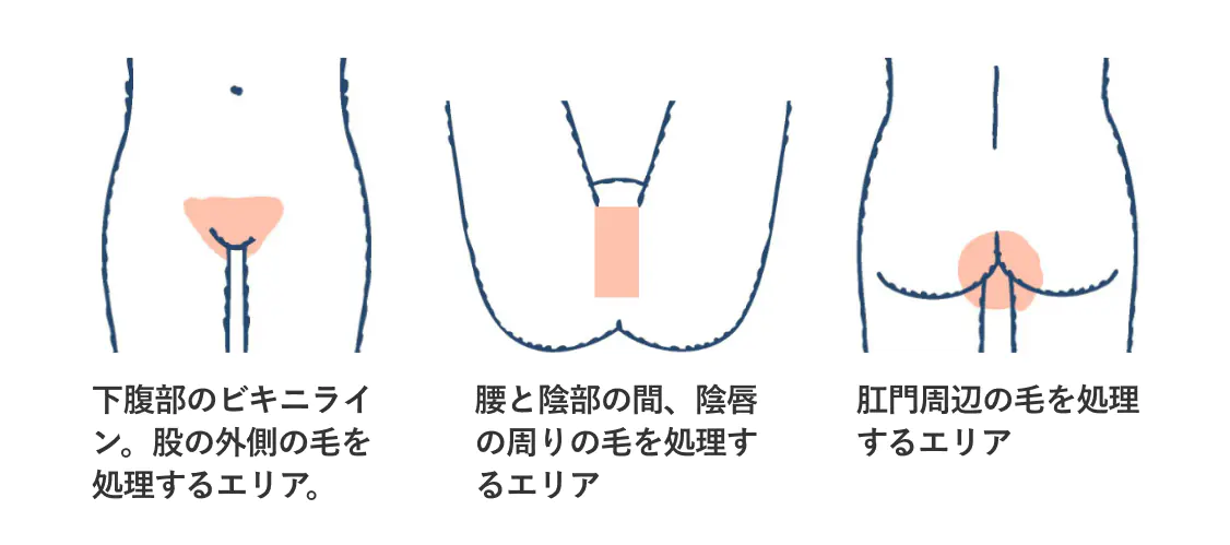 VIO脱毛とは？