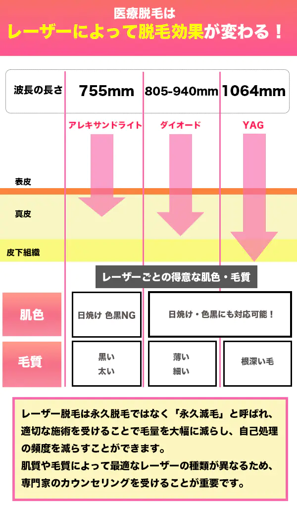 VIO脱毛のレーザー種類