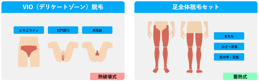 メンズリゼのその他セットプラン料金