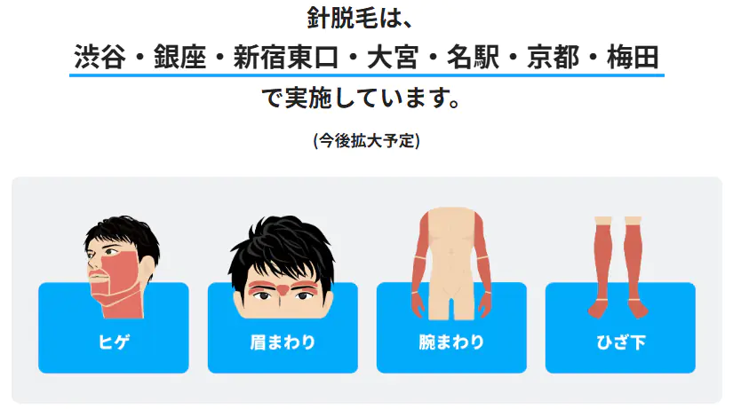 メンズリゼの針脱毛プラン料金