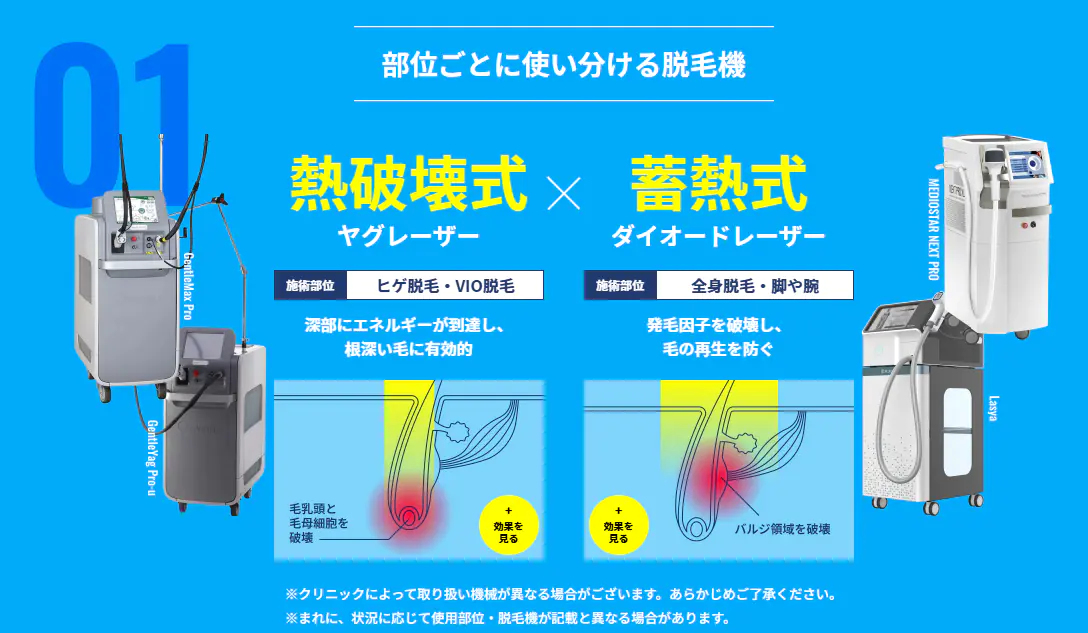 メンズリゼの脱毛機イメージ