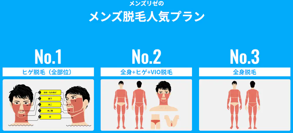 メンズリゼのプラン料金
