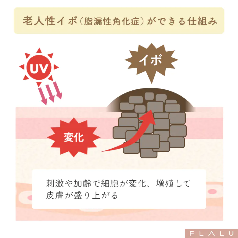 老人性イボ_仕組み_251106