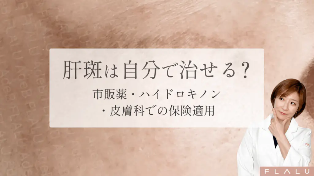 肝斑は自分で治せる？市販薬の使い方と正しい治療の順番を解説【医師監修】