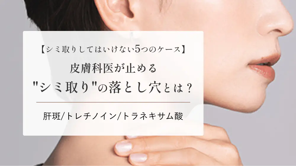 シミ取りはしないほうがいい？後悔しないための「急がない判断」と治療前チェックリスト
